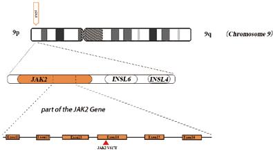 人JAK2基因V617F突变检测试剂盒